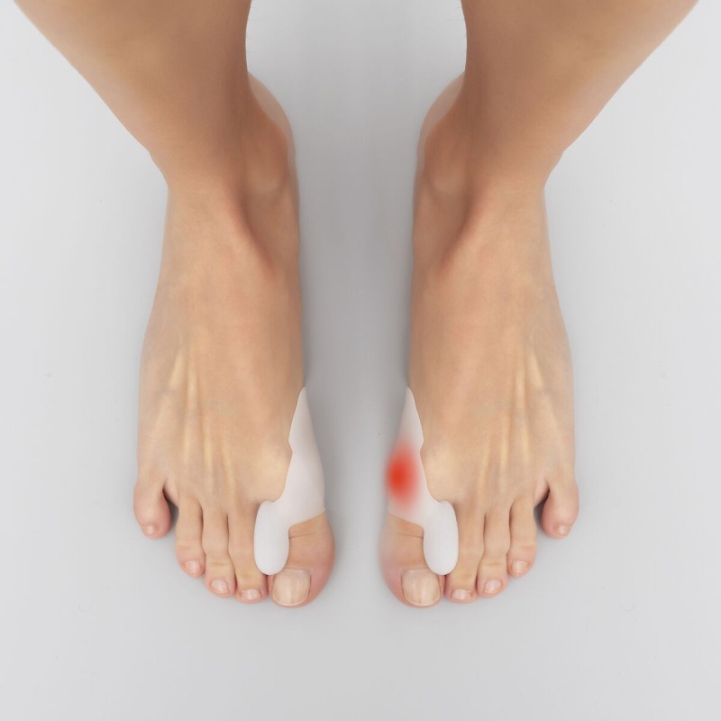 Correcteur durillons silicone Bunilief InnovaGoods (2 unités) – Protection et confort du pied