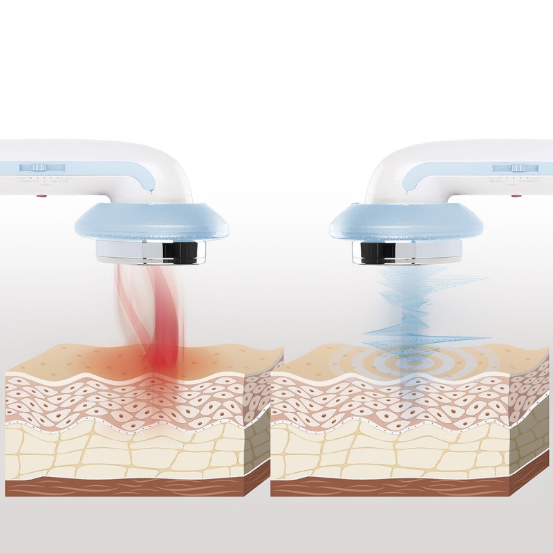 Masseur cavitation ultrasons CellyMax 3‑en‑1 – Réduction cellulite