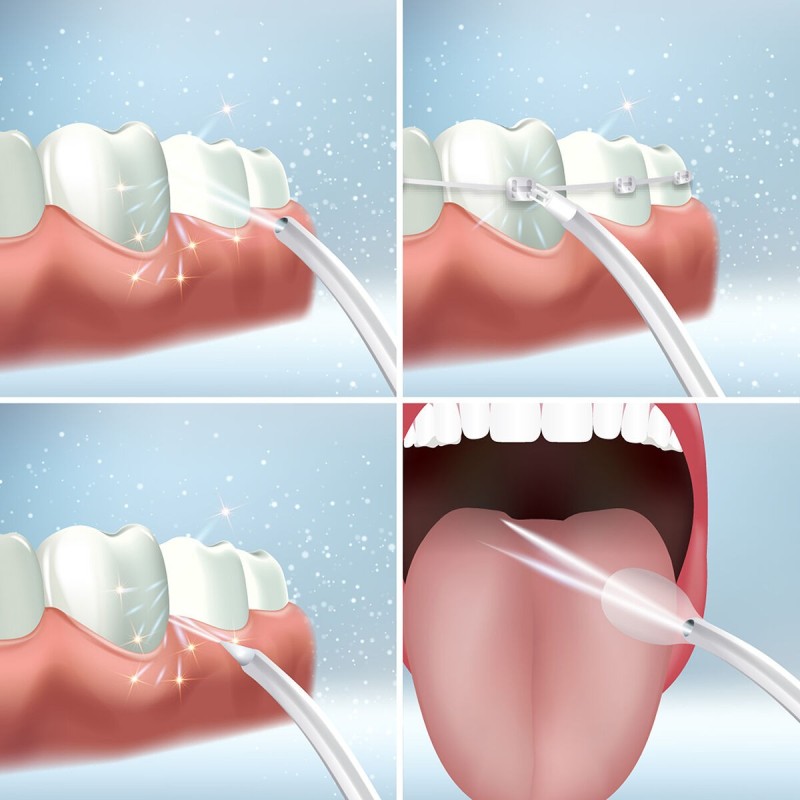 Irrigateur buccal rechargeable Denter – Hygiène interdentaire