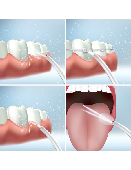 Irrigateur buccal rechargeable Denter – Hygiène interdentaire