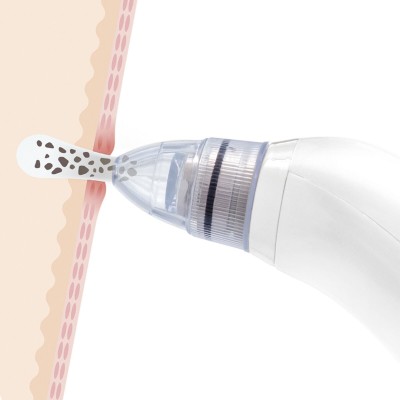 Aspirateur points noirs Pore·Off InnovaGoods – Nettoyage profond du visage 2