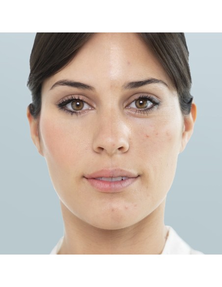 Sauna facial Moispa InnovaGoods – Ouverture pores et soin profond
